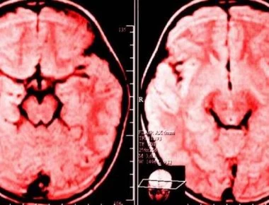 Γκρινιάζετε κάθε μέρα; Δείτε τι παθαίνει ο εγκέφαλός σας!